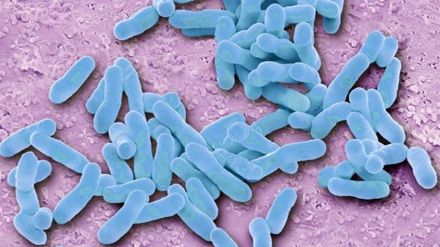 E. coli (Foto: Science Photo Library)