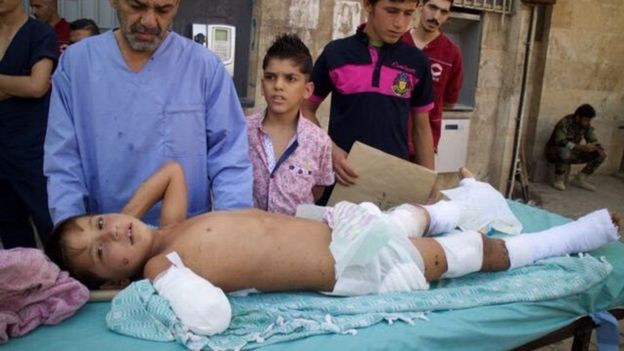 Wengi wanaendelea kuathirika na mapigano Syria
