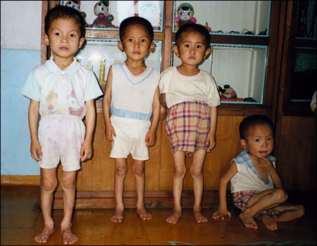 Niños desnutridos en Corea del Norte