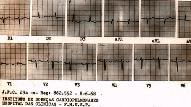 Eletrocardiogramas de João Ferreira da Cunha