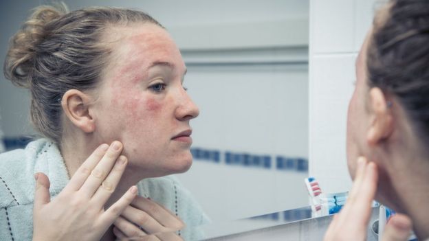 Mujer viendo una dermatitis en la cara