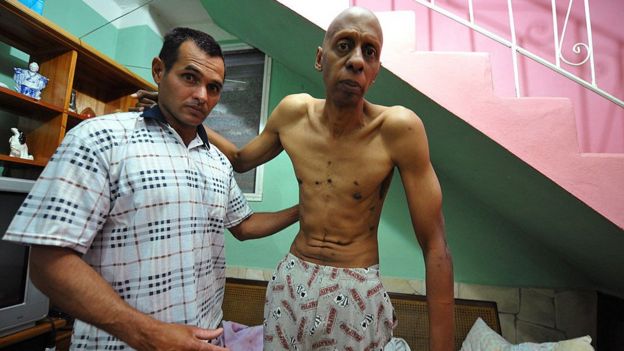 Fariñas ya hizo una huelga de hambre en 2010.