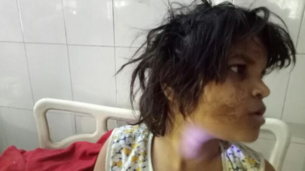 الشرطة الهندية تبحث عن والدي طفلة "عاشت مع القرود"