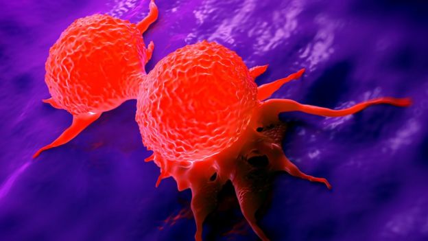 Células de cáncer de mama