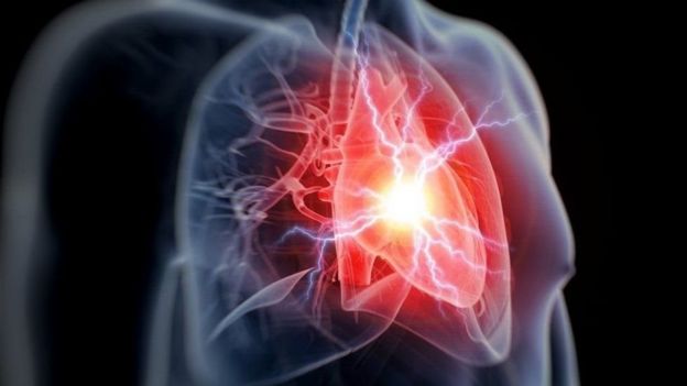 أعراض صامتة للنوبة القلبية قد تحول دون نجاتك _97794555_1c74f809-e302-4c6e-8656-bee122ab54b9