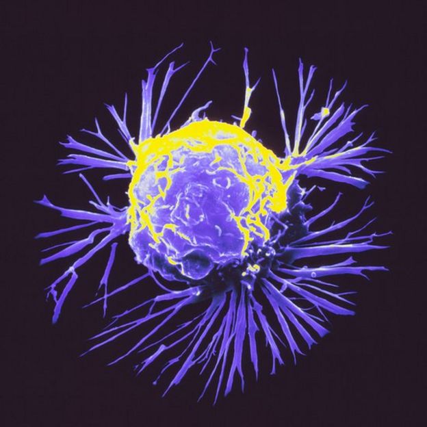 câncer de mama- célula