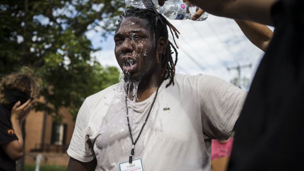 A protestor has his face washed after being tear gassed during a counter protest at a Ku Klux Klan rally in Charlottesville, Virginia, 8 July 2017