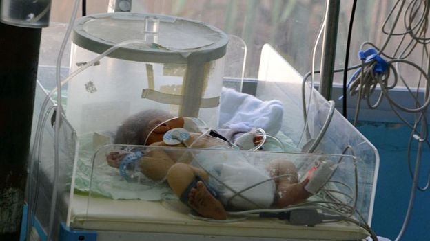 மருத்துவ பராமரிப்பில் குழுந்தை