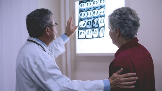 Doctor discussing x-ray with patient