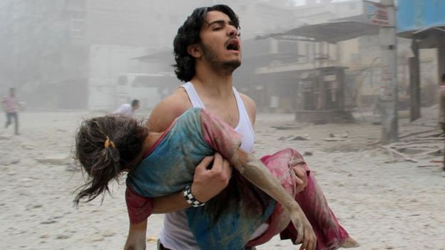 Syrian man and injured girl