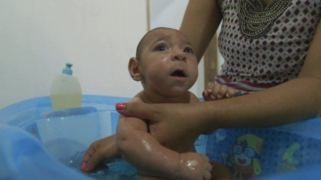 Baby with microcephaly being bathed
