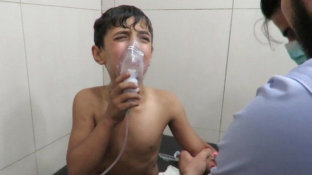 A boy is treated for breathing difficulties