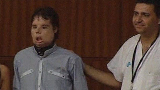 Oscar continues to need therapy for his speech