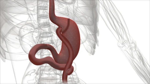 Gastric anatomy illustration