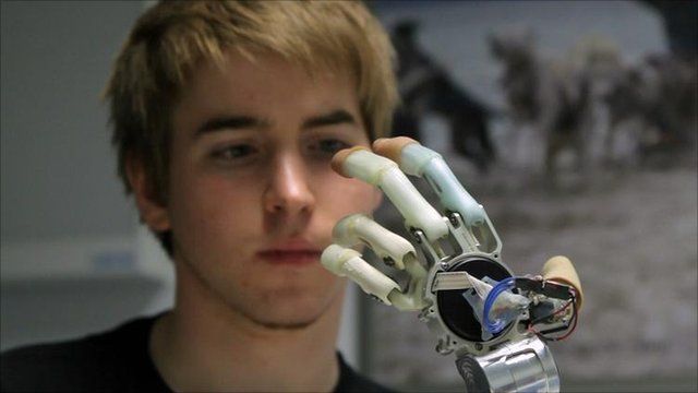 Patrick and his bionic hand