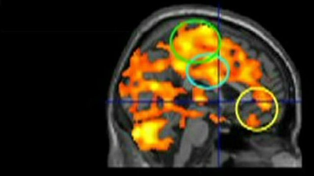 Brain scan