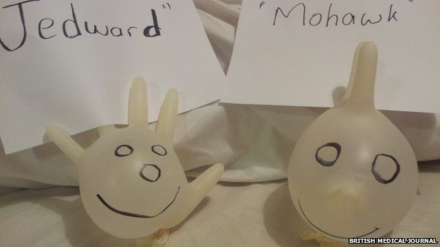 The so-called 'Jedward gloves'