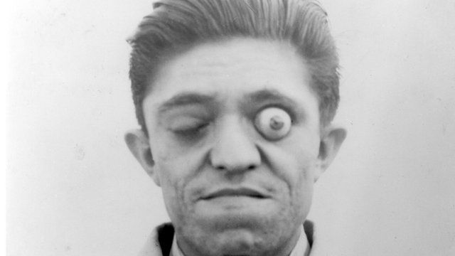 Man with eye popping out