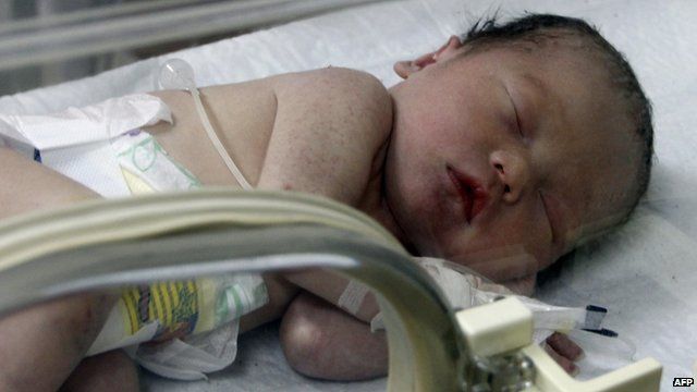 Baby asleep in incubator