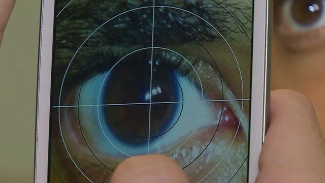 A photo of an eye using the smartphone app