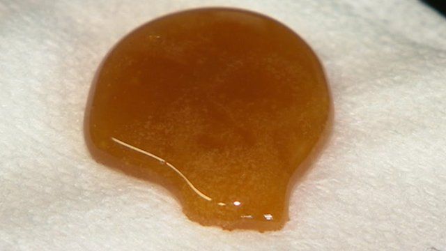 Honey wound treatment