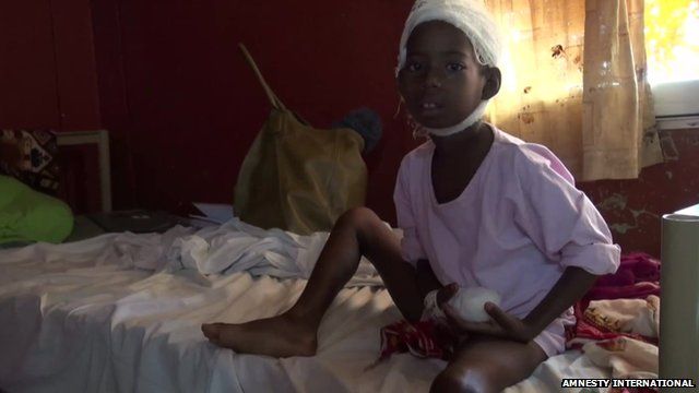 Injured child in hospital, pic from December 2013 courtesy of Amnesty International