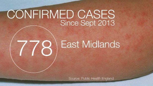 Latest figures show 778 reported cases since September