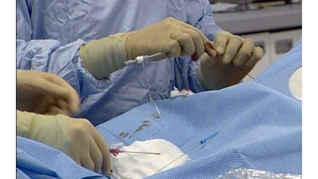 Heart surgery