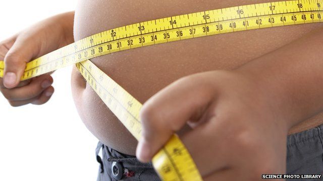 Obese person generic