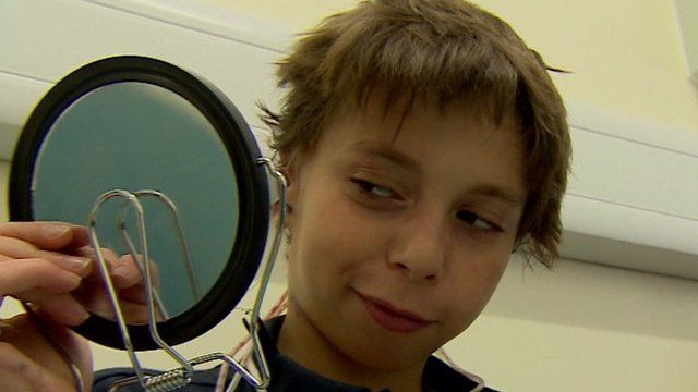 Kieran examines his new ears