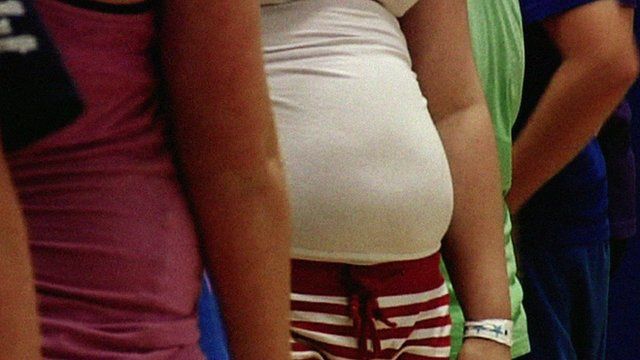 Warnings over childhood obesity