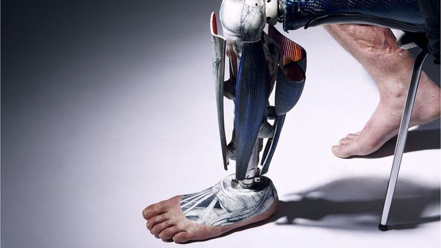 alternative prosthetics that speak from the soul