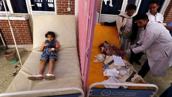 Crianças iemenitas sendo tratadas em setembro de 2017