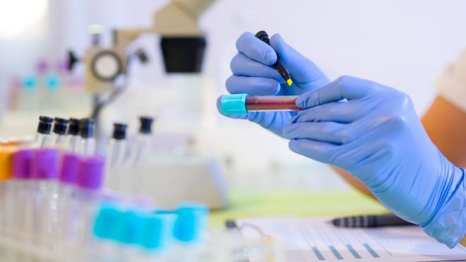 salus-blog-blood-test-to-detect-cancer