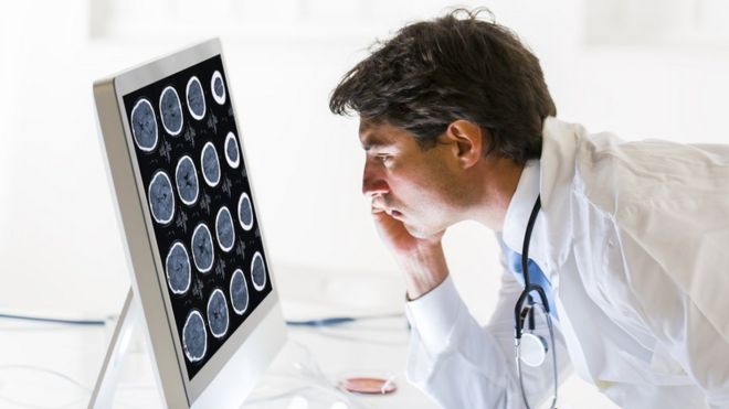 Doctor revisando tomografías cerebrales.
