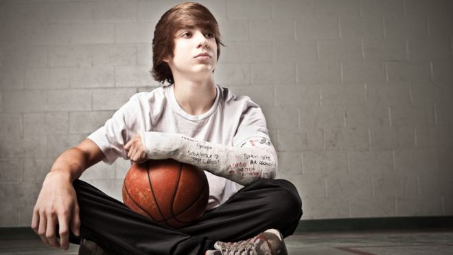 Niño con el brazo roto