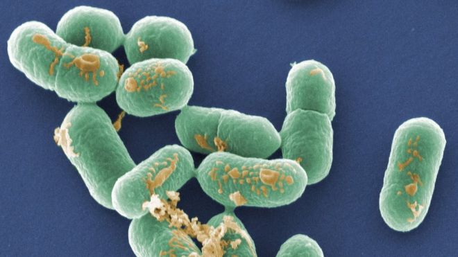 Coloured scanning electron micrograph (SEM) of Listeria monocytogenes bacteria