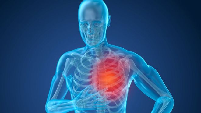 Qué es la hipertensión arterial pulmonar