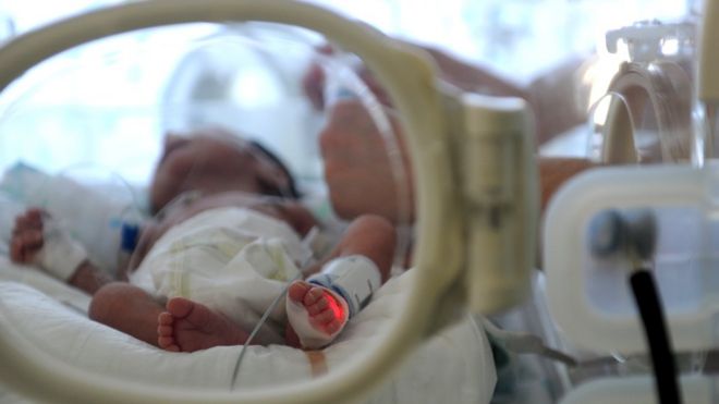 File photo shows baby in an intensive care unit