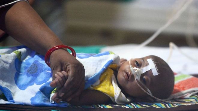 An Indian woman holds her child's hand at the encephalitis ward of the the Baba Raghav Das Hospital in Gorakhpur, in the northern Indian state of Uttar Pradesh, on August 14, 2017