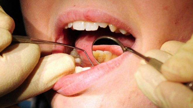 File photo: Close up of a dentist examining a patient's teeth