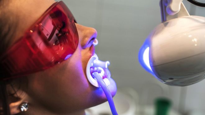 Профессиональные методы отбеливания зубов, как правило, приносят лучший результат, чем домашние способы