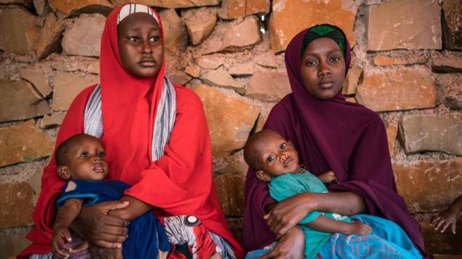 Watoto wanaokabiliwa na uapia mlo nchini Somalia