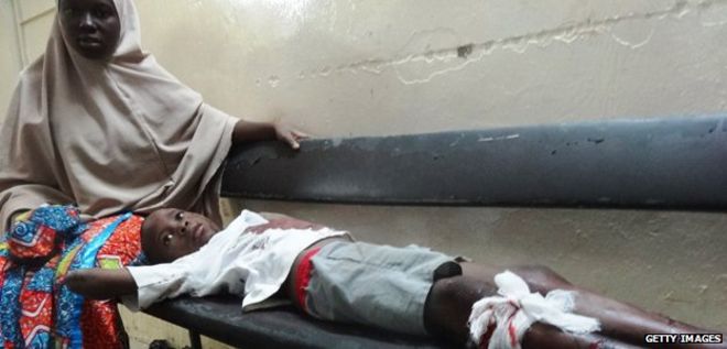 Мальчик получил ранения в результате нападения Боко Харам на центральную мечеть в Кано