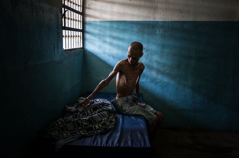 A Venezuelan patient in a mental hospital