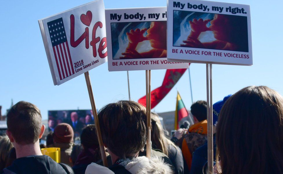 В январе тысячи людей приняли участие в ежегодной демонстрации в Вашингтоне, протестуя против абортов. Демонстрация прошла под лозунгом "Марш за жизнь".