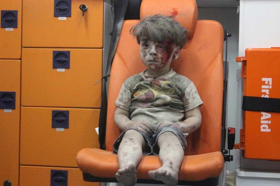 Omran Daqneesh a Syrian boy covered in dust and blood, sits in an ambulance after being rescued from the rubble of a building hit by an air strike in the rebel held Qaterji neighbourhood of the northern Syrian city of Aleppo late on 17 August 2016.
