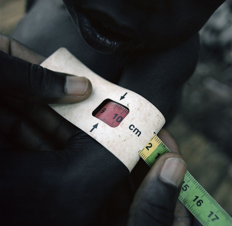 A small boy's arm is measured.