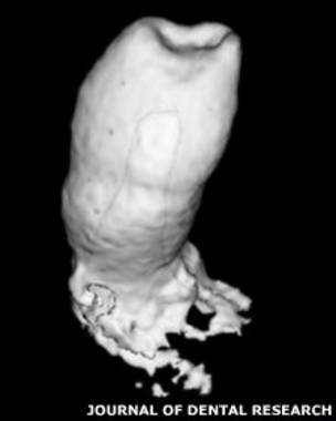 Prototipo de diente que crece desde la raíz de la muela, encontrado por científicos británicos
