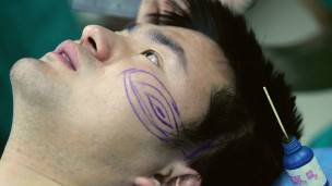 cirugía plásctica en China